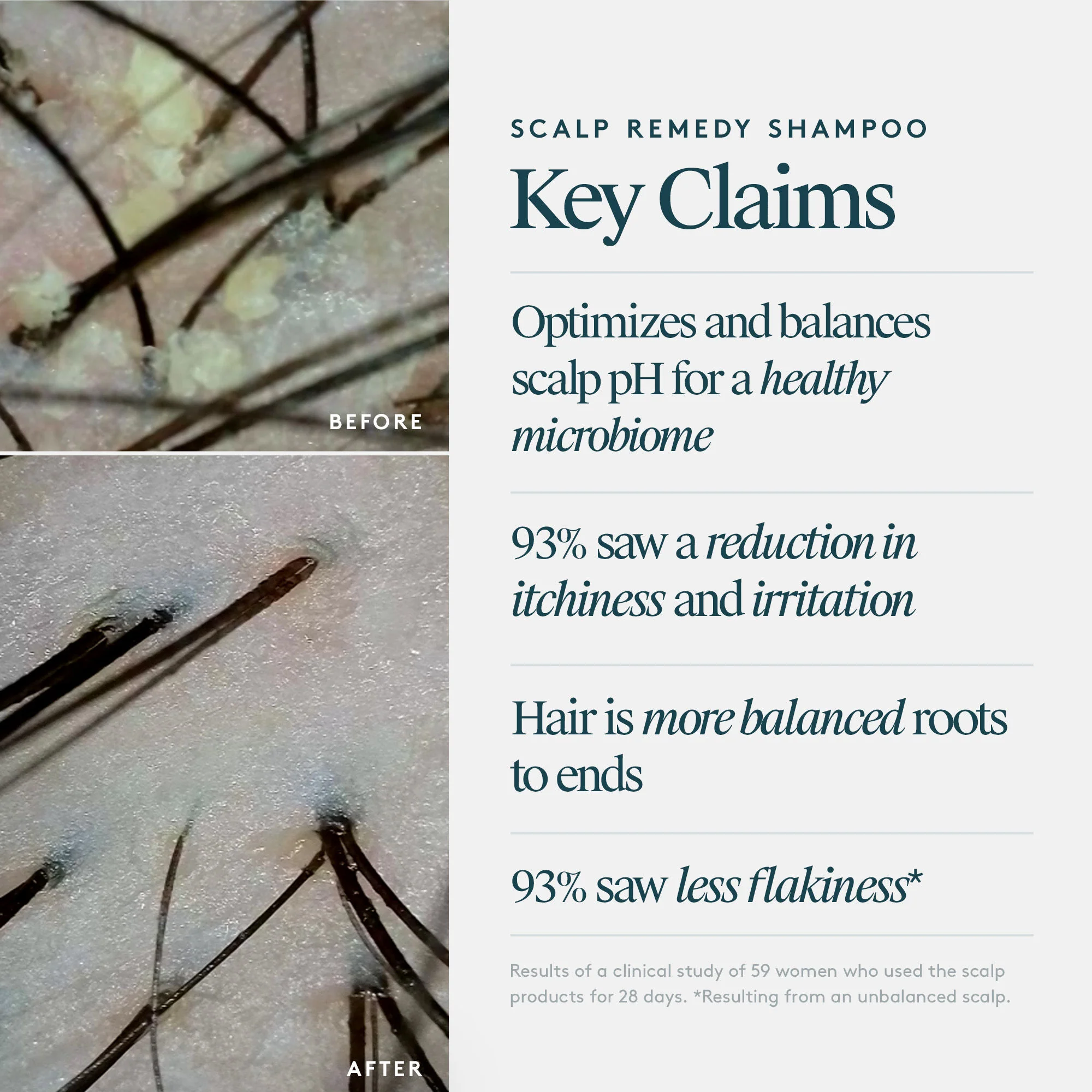 Scalp Remedy Shampoo for Scalp and Hair Health - Image 7